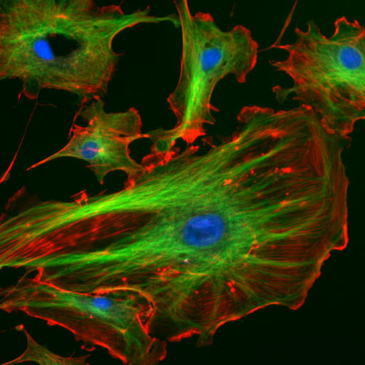 Microscope image showing coloured cytoskeletal structures inside cells