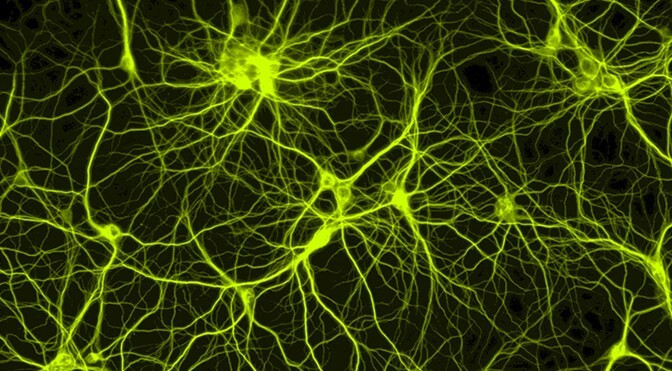 Fluorescent image of neurons forming a branching network
